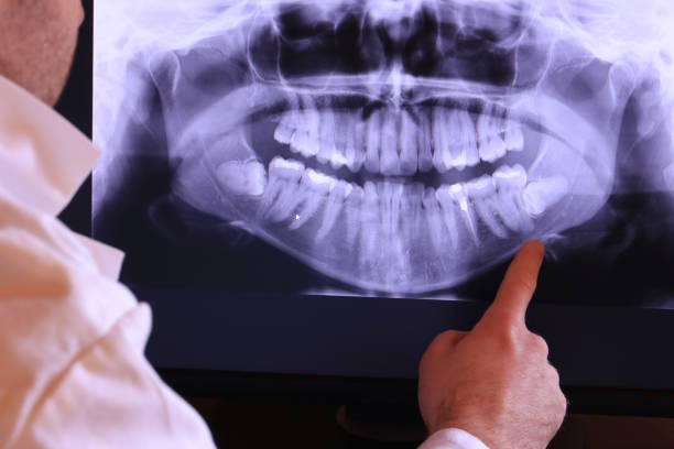 Best Broken or Cracked Tooth Emergency Dentist in Kensington, NY